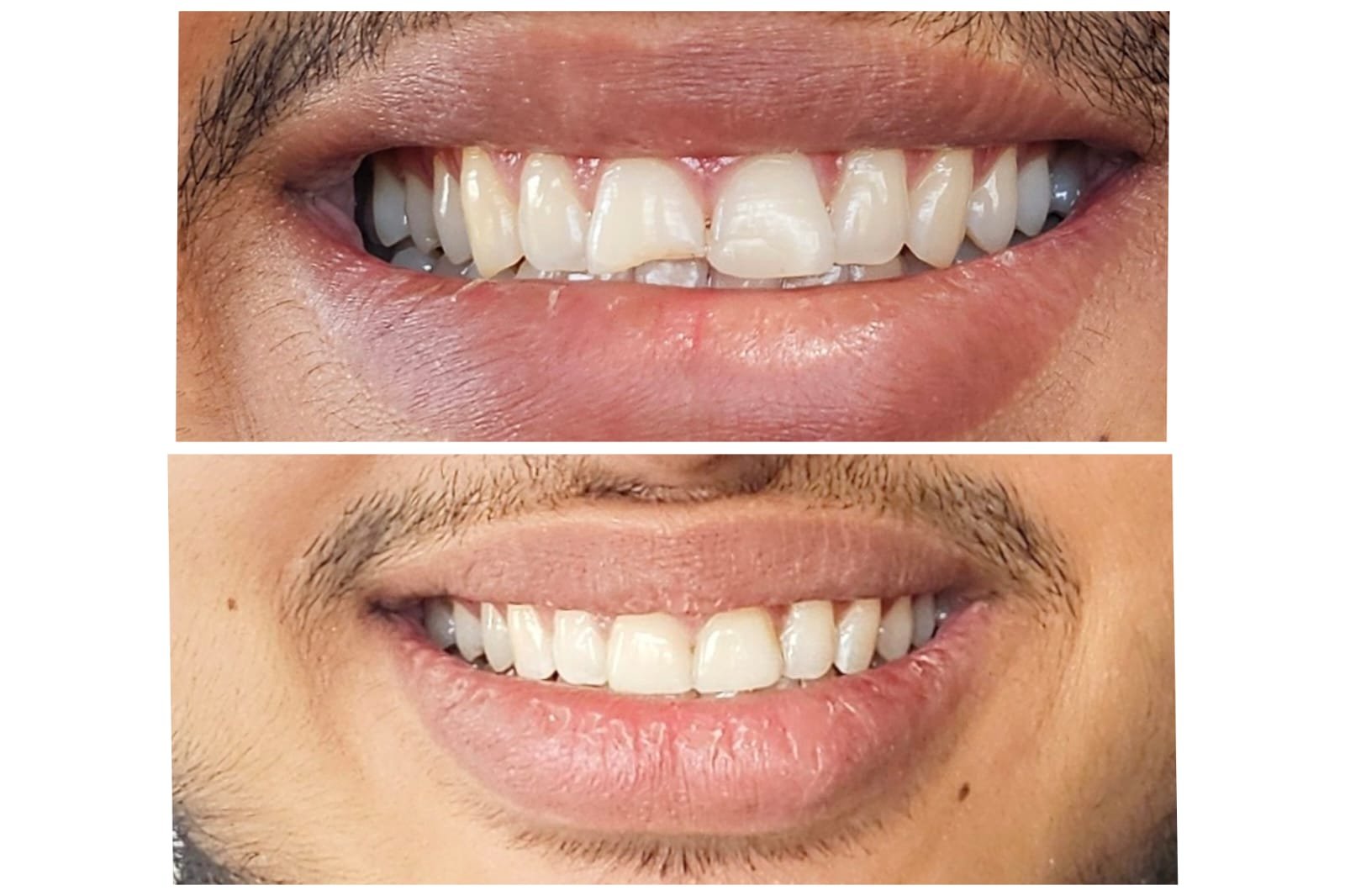 Best Dental Treatment