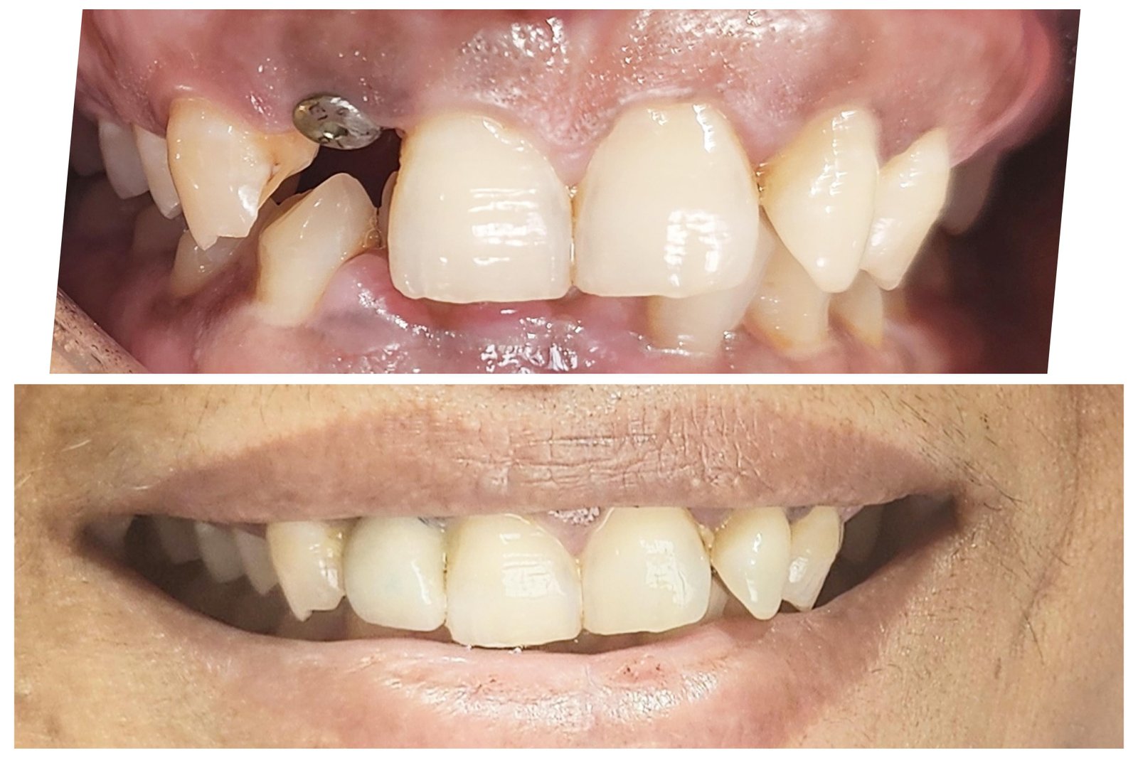 Best Dental Treatment