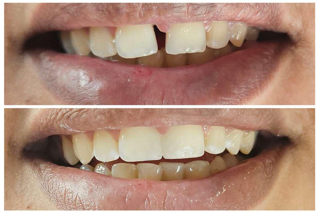 Best Dental Treatment