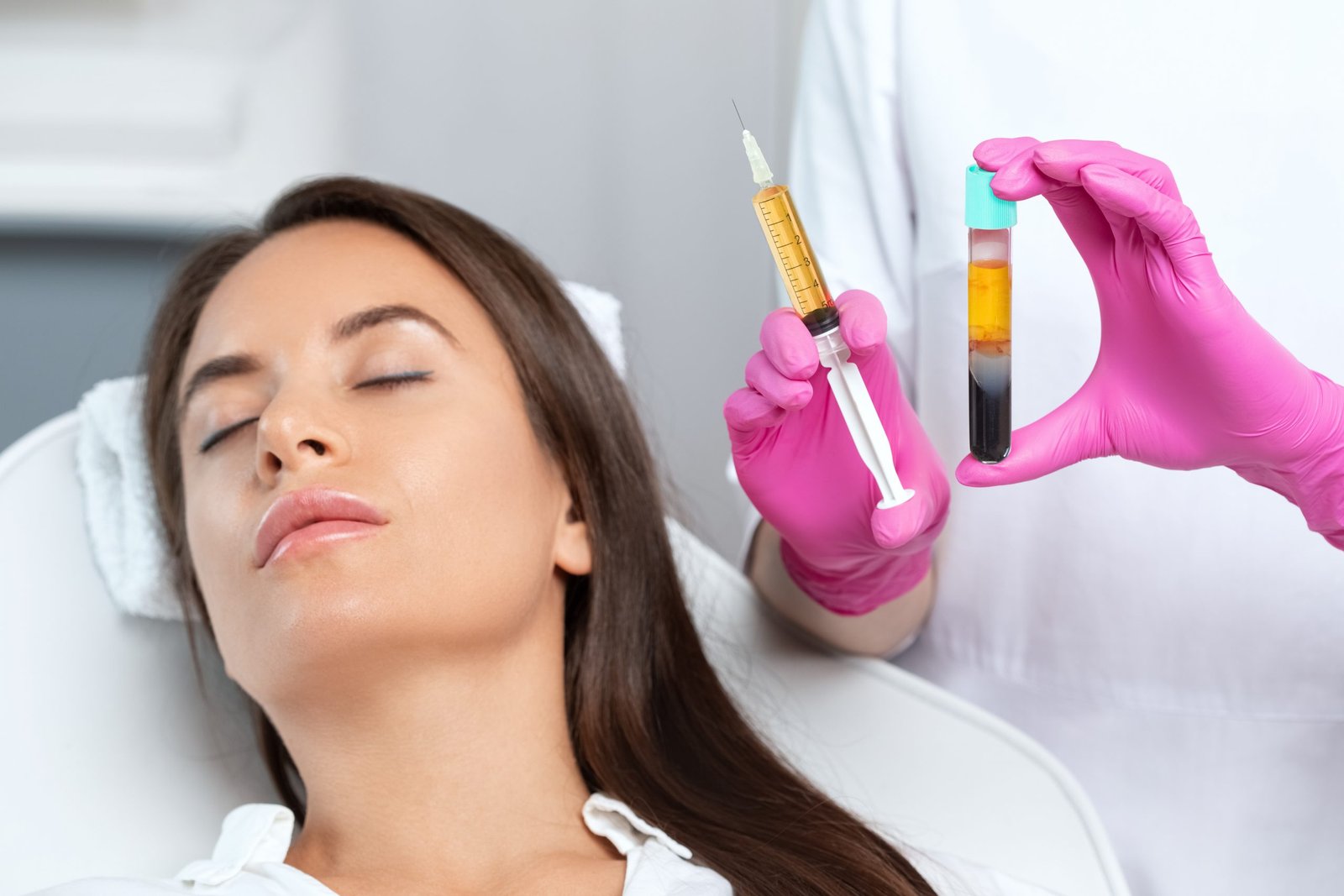 PRP for Facial Rejuvenation